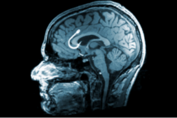 Your Brain on Porn